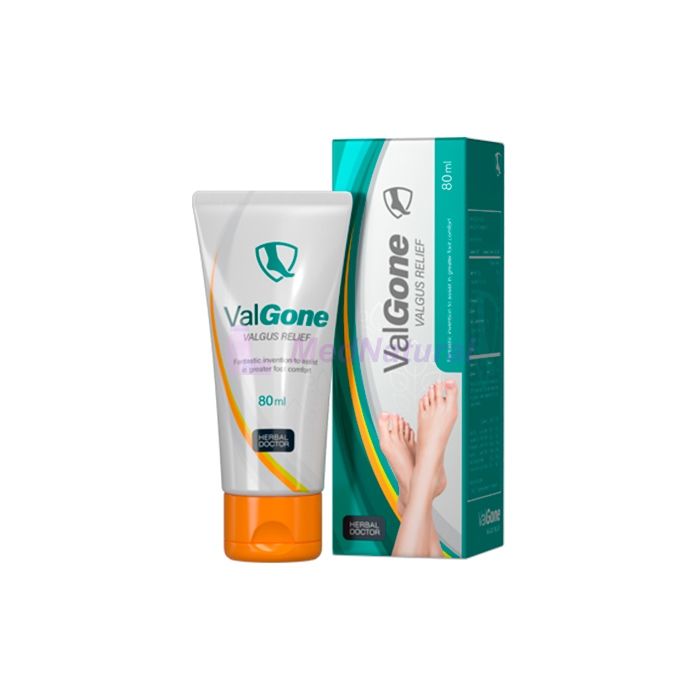 ValGone ➺ cream to combat hallux valgus in Osnabrück